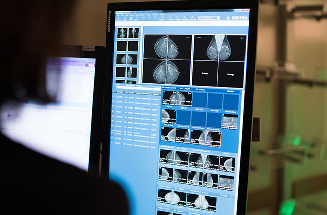 shot of computer screen displaying mammogram study